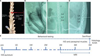 Associations of Lumber Disc Degeneration With Paraspinal Muscles Myosteatosis in Discogenic Low Back Pain